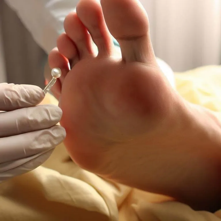 Tratament pentru ciuperca între degetele de la picioare